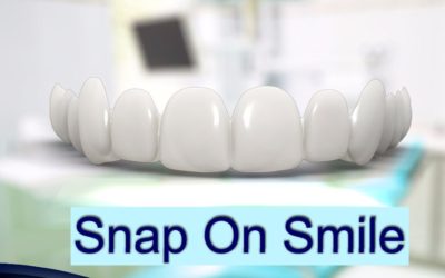 Snap On Smile | São José dos Pinhais