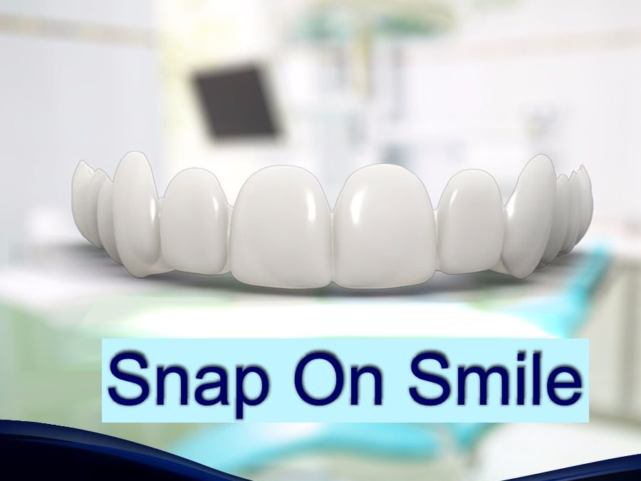 Snap On Smile | São José dos Pinhais